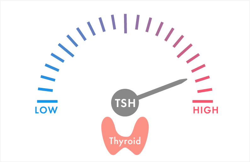 甲状腺ホルモン値は正常、甲状腺刺激ホルモン(TSH)が高値と診断されたら